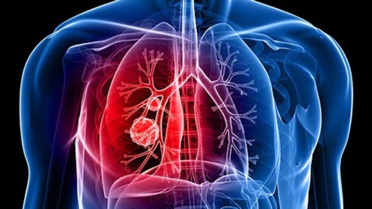 كيفية الحفاظ على صحة الجهاز التنفسي وتجنب الأمراض المزمنة
